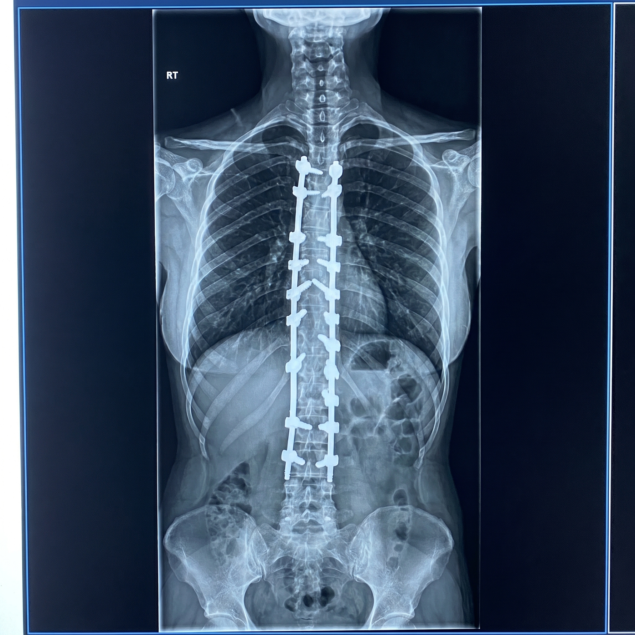 عايزاها بجوده كويسه 202604251515